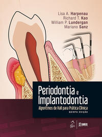 Periodontia e Implantodontia Algoritmos Hall Prát Clíni 5/16