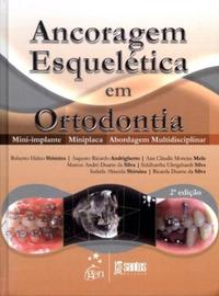 Ancoragem Esquelética em Ortodontia Mini-Implante Minip 2/13