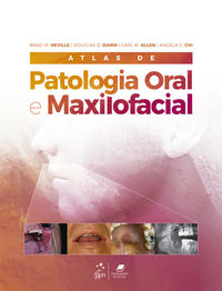 Atlas de Patologia Oral e Maxilofacial 1/21