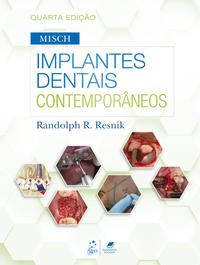 Implantes Dentais Contemporâneos 4/22